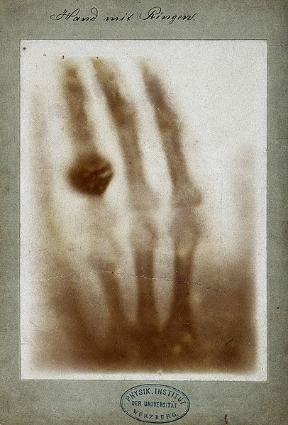Anna Bertha Ludwig