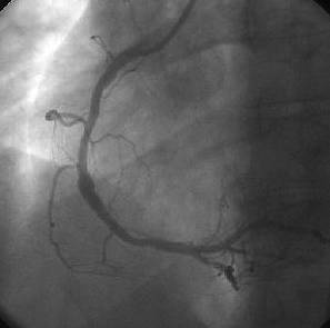 cath image min