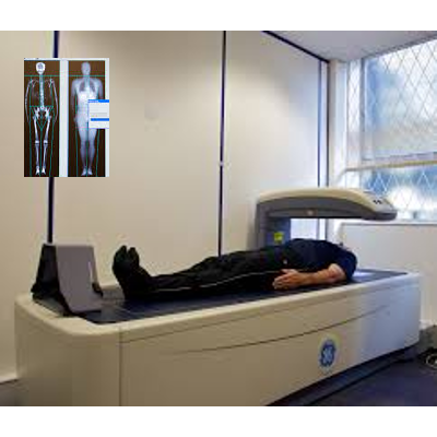 dexaScan min 1
