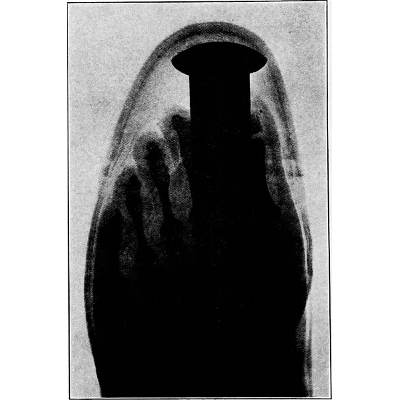 footoscope min