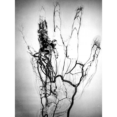 hand subtraction min