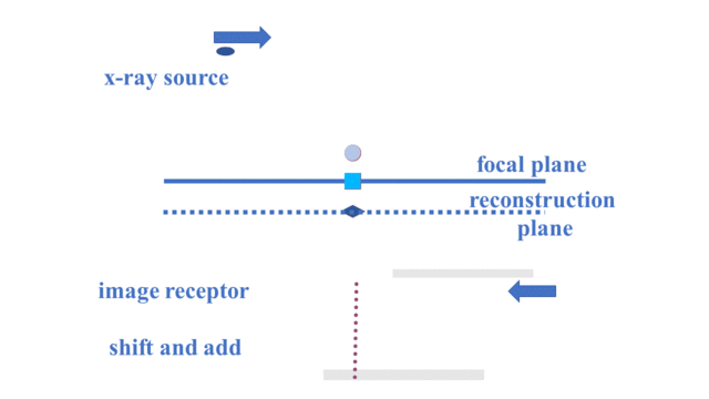 tomosynthesis
