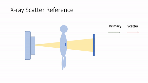 Scatter in X-Ray Images 2