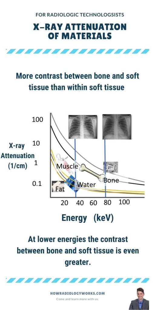 xRayAttenuation